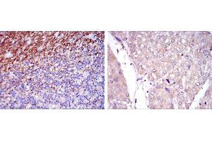 Immunohistochemical analysis of paraffin-embedded human cerebellum tissues (left) and human liver cancer tissues (right) using CD15 mouse mAb with DAB staining. (CD15 anticorps)
