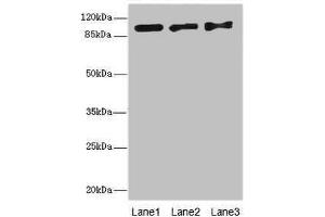 Western blot All lanes: EXO1 antibody at 10 μg/mL Lane 1: Hela whole cell lysate Lane 2: 293T whole cell lysate Lane 3: A549 whole cell lysate Secondary Goat polyclonal to rabbit IgG at 1/10000 dilution Predicted band size: 95, 90 kDa Observed band size: 95 kDa (Exonuclease 1 anticorps  (AA 301-600))
