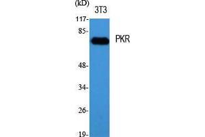 Western Blot (WB) analysis of specific cells using PKR Polyclonal Antibody.