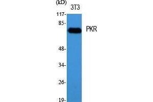 Western Blot (WB) analysis of specific cells using PKR Polyclonal Antibody. (EIF2AK2 anticorps  (Thr392))