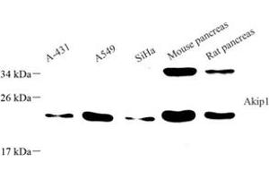 Western blot analysis of Akip1 (ABIN7072871) at dilution of 1: 800 (AKIP1 anticorps)