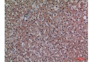 Immunohistochemistry (IHC) analysis of paraffin-embedded Human Liver, antibody was diluted at 1:100.