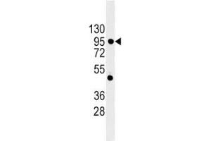 Western blot analysis of E Cadherin antibody and 293 lysate