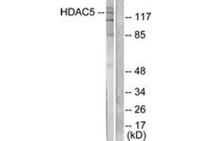 Western blot analysis of extracts from HepG2 cells, treated with PMA 125ng/ml 30', using HDAC5 Antibody.