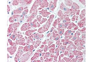 Anti-IDH antibody IHC of human heart. (Isocitrate Dehydrogenase anticorps)