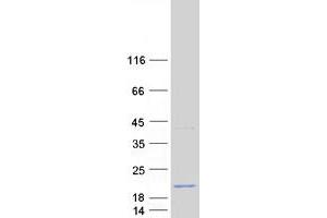 Validation with Western Blot