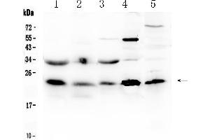 Western blot analysis of HSPB8/Hsp22 using anti- HSPB8/Hsp22 antibody . (HSPB8 anticorps  (AA 1-196))