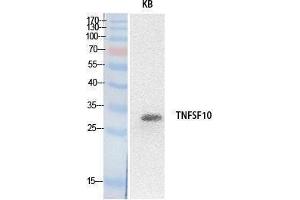 Western Blotting (WB) image for anti-Tumor Necrosis Factor (Ligand) Superfamily, Member 10 (TNFSF10) (Internal Region) antibody (ABIN3178527) (TRAIL anticorps  (Internal Region))