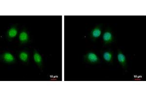 ICC/IF Image MAGE 1 antibody [N1C3] detects MAGE 1 protein at nucleus and cytoplasm by immunofluorescent analysis. (Melanoma Antigen Family D, 4 (MAGED4) (Center) anticorps)