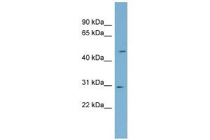NDUFS3 antibody used at 1 ug/ml to detect target protein. (NDUFS3 anticorps  (Middle Region))