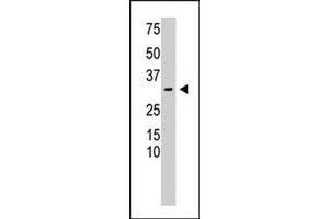 The RCAN3 polyclonal antibody  is used in Western blot to detect RCAN3 in mouse heart tissue lysate. (RCAN3 anticorps  (N-Term))