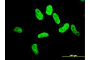 Immunofluorescence of monoclonal antibody to ZNF207 on HeLa cell. (ZNF207 anticorps  (AA 1-110))