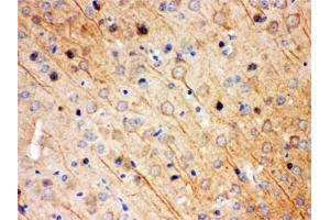 IHC testing of FFPE mouse brain with KChIP2 antibody. (KCNIP2 anticorps)