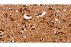 Immunohistochemistry of paraffin-embedded Human brain tissue using HRK Polyclonal Antibody at dilution 1:40 (HRK anticorps)