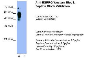 Host:  Rabbit  Target Name:  ESRRG  Sample Type:  Jurkat  Lane A:  Primary Antibody  Lane B:  Primary Antibody + Blocking Peptide  Primary Antibody Concentration:  2. (ESRRG anticorps  (Middle Region))