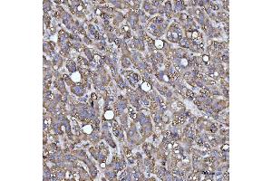 IHC analysis of MRPS22 using anti-MRPS22 antibody (ABIN7600613). (MRPS22 anticorps  (AA 21-329))