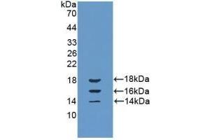 Detection of Recombinant IL15, Bovine using Polyclonal Antibody to Interleukin 15 (IL15) (IL-15 anticorps  (AA 48-162))