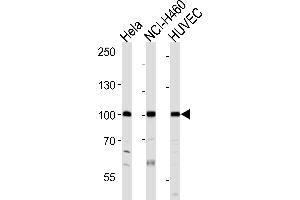 Western blot analysis of lysates from Hela, NCI-H460, HUVEC cell line (from left to right), using EPHA4 Antibody (R890) at 1:1000 at each lane. (EPH Receptor A4 anticorps  (C-Term))