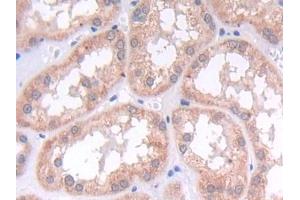 DAB staining on IHC-P; Samples: Human Kidney Tissue (LAMB2 anticorps  (AA 38-350))