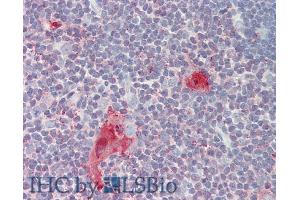 Detection of CD30L in Human Thymus Tissue using Polyclonal Antibody to Cluster Of Differentiation 30 Ligand (CD30L)