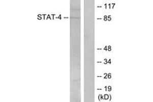 Western blot analysis of extracts from HeLa cells treated with IL-4, using STAT4 (Phospho-Tyr693) Antibody. (STAT4 anticorps  (pTyr693))