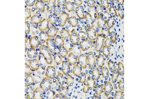 Immunohistochemistry of paraffin-embedded rat kidney using COMT antibody (ABIN1882327) at dilution of 1:100 (40x lens). (COMT anticorps)