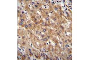 Immunohistochemistry analysis in human liver tissue (formalin-fixed, paraffin-embedded) using CHCHD4 / MIA40 Antibody (C-term), followed by peroxidase conjugation of the secondary antibody and DAB staining.