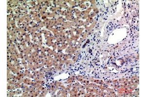 Immunohistochemistry (IHC) analysis of paraffin-embedded Human Liver, antibody was diluted at 1:200.