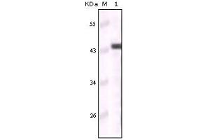 Western blot analysis using CK5 mouse mAb against truncated CK5 recombinant protein