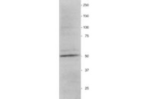 Western Blotting (WB) image for anti-Vimentin (VIM) antibody (ABIN955516) (Vimentin anticorps)