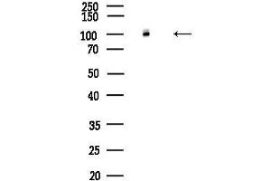 Western blot analysis of lysates from K562 cells(heat-shock,45 min treatment), using ATP1 Antibody at 1/1000 dilution.