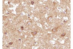ABIN6267671 at 1/100 staining human brain tissue sections by IHC-P. (TRKB anticorps  (pTyr516))