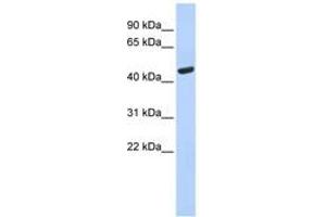 Image no. 1 for anti-Tryptophanyl-tRNA Synthetase (WARS) (AA 35-84) antibody (ABIN6749767) (WARS anticorps  (AA 35-84))