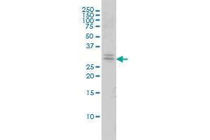 TOLLIP monoclonal antibody (M01), clone 1A5-2A3 Western Blot analysis of TOLLIP expression in 293 .