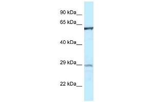 Western Blot showing PTPN6 antibody used at a concentration of 1 ug/ml against THP-1 Cell Lysate (SHP1 anticorps  (Middle Region))