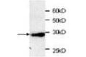 Image no. 1 for anti-Red Fluorescent Protein (RFP) (AA 21-245) antibody (ABIN791466) (RFP anticorps  (AA 21-245))