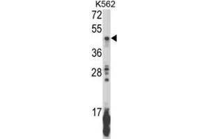 Western Blotting (WB) image for anti-Killer Cell Immunoglobulin-Like Receptor, Two Domains, Long Cytoplasmic Tail, 5B (KIR2DL5B) antibody (ABIN3003959) (KIR2DL5B anticorps)