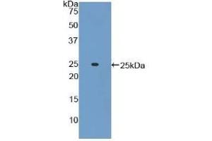 Detection of Recombinant ADCY6, Mouse using Polyclonal Antibody to Adenylate Cyclase 6 (ADCY6) (ADCY6 anticorps  (AA 314-501))
