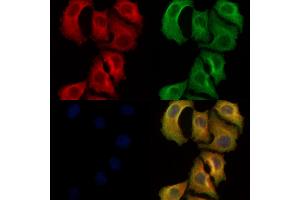 ABIN6261918 and ABIN6278469 staining Hela cells by IF/ICC. (GUCY1B2 anticorps)