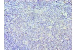Immunohistochemistry of paraffin-embedded human tonsil tissue using ABIN7156635 at dilution of 1:100 (IRF8 anticorps  (AA 137-426))
