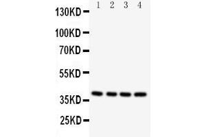 Western Blotting (WB) image for anti-Caspase 12 (Gene/pseudogene) (CASP12) (AA 71-84), (N-Term) antibody (ABIN3042658)