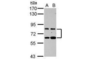 Image no. 1 for anti-Zinc Finger Protein 64 (ZFP64) (AA 394-681) antibody (ABIN1501818) (ZFP64 anticorps  (AA 394-681))