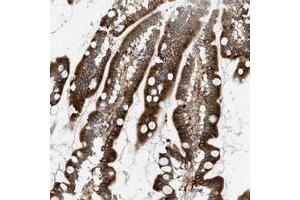 Immunohistochemical staining of human small intestine with MCOLN3 polyclonal antibody  shows strong cytoplasmic positivity at 1:20-1:50 dilution. (Mucolipin 3 anticorps)