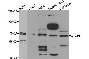Western blot analysis of extracts of various cell lines, using CTCFL antibody. (CTCFL anticorps)