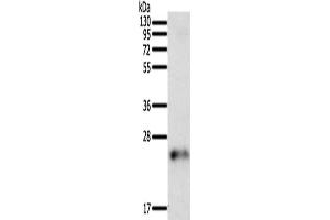 Gel: 12 % SDS-PAGE, Lysate: 50 μg, Lane: Human fetal brain tissue, Primary antibody: ABIN7129442(FAM3A Antibody) at dilution 1/200, Secondary antibody: Goat anti rabbit IgG at 1/8000 dilution, Exposure time: 5 minutes (FAM3A anticorps)