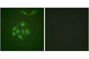 Immunofluorescence analysis of A549 cells, using Survivin (Phospho-Thr117) Antibody. (Survivin anticorps  (pThr117))