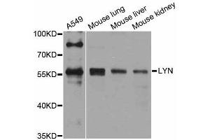 Western blot analysis of extracts of various cell lines, using Lyn antibody (ABIN5998158) at 1/1000 dilution. (LYN anticorps)