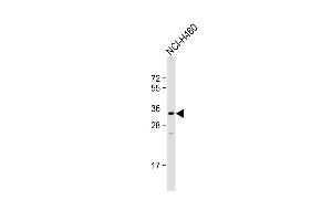 Anti-FF Antibody (C-term) at 1:1000 dilution + NCI- whole cell lysate Lysates/proteins at 20 μg per lane. (FAM26F anticorps  (C-Term))