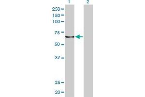 Western Blot analysis of KPNA5 expression in transfected 293T cell line by KPNA5 monoclonal antibody (M01), clone 1D2.