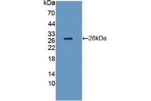 Western blot analysis of recombinant Human CTRB1. (CTRB1 anticorps  (AA 34-261))